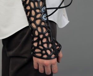 Moldes obtenidos con una impresora 3d, podrían acelerar la curación de las fracturas óseas