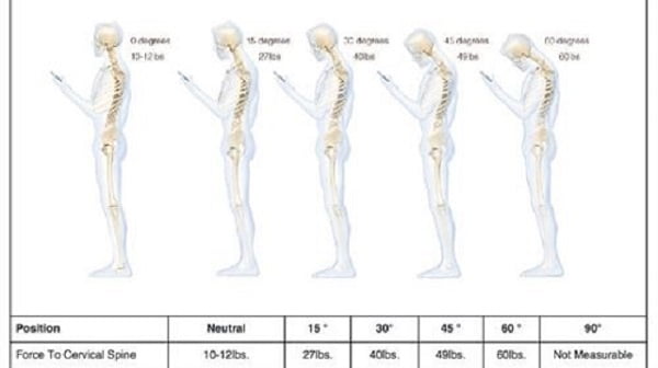cuidado espalda smartphone