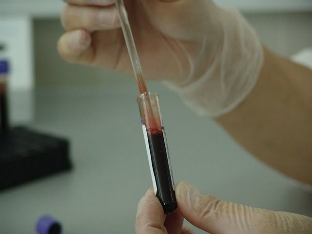 Test sanguíneo