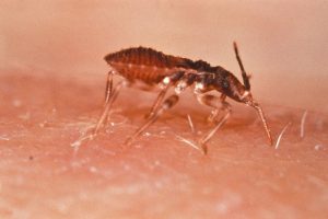 enfermedad de chagas