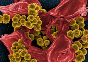 nanobacteria
